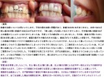 (写真)子供の頃の治療に問題があり、前歯2本の内1本がありま