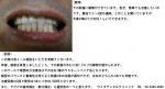 (写真)下の前歯の隙間を急ぎ治療したい。予算13万円くらいで