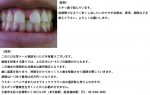 (写真)スキっ歯で悩んでいます。短期間でなるべく安くし治したい