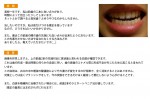 （写真）斑状歯（ホワイトスポット）の治し方、悪化させない方法
