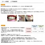 上下の歯の突出（出っ歯）、唇と顎のしこり
