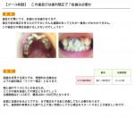 (写真)この歯並びは歯列矯正で？抜歯は必要か