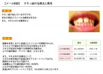 （写真）すきっ歯の治療と費用