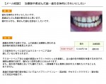 (写真)治療跡や黄ばんだ歯…歯を全体的にきれいにしたい