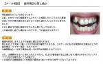 （写真）歯列矯正か差し歯か