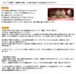 八重歯の治療、上の歯の前歯だけの部分矯正はできますか？