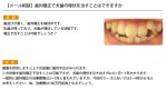 （写真）歯並びが悪く、矯正で治すことは可能でしょうか？