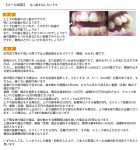 特に上の前歯　出っ歯を治したい　歯の裏側からつける目立たない装置で　前歯で部分矯正は