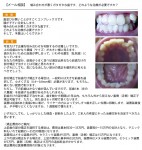 噛み合わせが悪くガタガタな歯です。どのような治療が必要ですか？