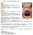 前歯の部分矯正で綺麗な歯並びに　部分矯正と全体的な矯正と、どちらが比較的安い？