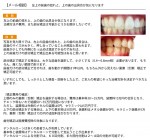 左上の前歯の捻れ　上の歯の出具合が気に　治療方法や費用、部分矯正は可能か