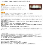 八重歯と左の小さな歯と受け口が気に　部分矯正できる？　値段、治療期間、お支払い方法など