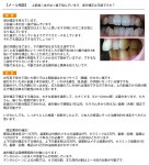 上前歯二本が出っ歯で悩んでいます。部分矯正は可能ですか？