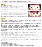 歯並びの悪さ　上の歯はこのままで下の歯だけの矯正は可能？　ガタガタで噛むと下の歯が前に出て