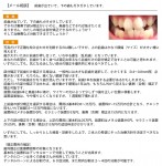 前歯が出て　下の歯もガタガタ　裏側で部分矯正がいい　奥歯の抜歯は？　治療費の分割？
