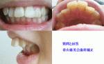 小学生の頃から悩んでいる出っ歯を矯正したいのですがこちらは部分矯正などはできますでしょうか？