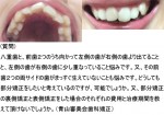 八重歯と、前歯２つのうち向かって左側の歯が右側の歯より出てることと