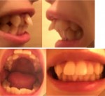 出っ歯で悩んでいます。 自信がなく笑えません。治療費が高く上の歯だけ直すことは可能ですか？