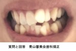 歳を経るに連れ、歯並びの悪さ気になる　少なくとも前歯だけ　矯正では治らない？