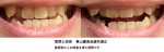 口を閉じるとき下顎を左右に動かす癖、歯医者に行った時、横にずれていると言われ　手術が必要になる？