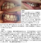シドニーの歯科で10歳の娘が歯科矯正が必要　コロナでロックダウン　日本に本帰国し始める？