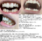 下1番が2本乳歯 永久歯がなく先天性欠損    抜歯し全体矯正で綺麗は可能？