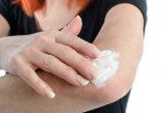 アトピー性皮膚炎で脱保湿が必要な場合とは？