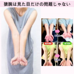 肩こり・猫背が治らない原因は“腕”？──意外と知られていない猿腕の正体