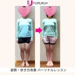 【19歳Aさんの大変身】 脚のむくみ・X脚・不調が軽くなり “体のライン” まで美しく整った理由