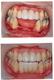 インプラント歯科のカウンセリング